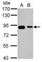 EPS8 Like 2 antibody, PA5-29447, Invitrogen Antibodies, Western Blot image 