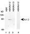 Potassium Voltage-Gated Channel Subfamily A Member 2 antibody, NBP1-42818, Novus Biologicals, Western Blot image 
