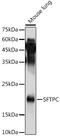 Surfactant Protein C antibody, GTX54694, GeneTex, Western Blot image 