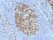 Minichromosome Maintenance Complex Component 7 antibody, GTX34821, GeneTex, Immunohistochemistry paraffin image 