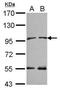 N-alpha-acetyltransferase 15, NatA auxiliary subunit antibody, PA5-30562, Invitrogen Antibodies, Western Blot image 