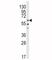 LYN Proto-Oncogene, Src Family Tyrosine Kinase antibody, F50712-0.4ML, NSJ Bioreagents, Immunohistochemistry paraffin image 