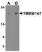 Transmembrane Protein 147 antibody, PA5-72696, Invitrogen Antibodies, Western Blot image 