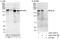 Protein LAP2 antibody, A303-763A, Bethyl Labs, Western Blot image 