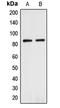 Anaphase Promoting Complex Subunit 5 antibody, LS-C353441, Lifespan Biosciences, Western Blot image 