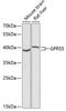 G Protein-Coupled Receptor 55 antibody, GTX03363, GeneTex, Western Blot image 