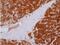 Glutamic--Pyruvic Transaminase antibody, NBP2-16731, Novus Biologicals, Immunohistochemistry frozen image 