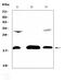 Transmembrane Protein 240 antibody, A14889, Boster Biological Technology, Western Blot image 