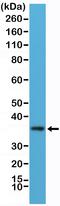 MYD88 Innate Immune Signal Transduction Adaptor antibody, MA5-27972, Invitrogen Antibodies, Western Blot image 