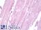 Actinin Alpha 3 (Gene/Pseudogene) antibody, LS-B9666, Lifespan Biosciences, Immunohistochemistry frozen image 