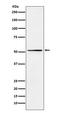 Meis Homeobox 2 antibody, M04264-1, Boster Biological Technology, Western Blot image 