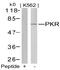 Eukaryotic Translation Initiation Factor 2 Alpha Kinase 2 antibody, AP02771PU-N, Origene, Western Blot image 