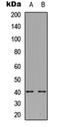 Tumor Associated Calcium Signal Transducer 2 antibody, orb304619, Biorbyt, Western Blot image 