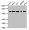 Guanylate Binding Protein 2 antibody, CSB-PA009298LA01HU, Cusabio, Western Blot image 