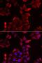 PDZ And LIM Domain 1 antibody, LS-C334876, Lifespan Biosciences, Immunofluorescence image 