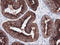 T-cell surface glycoprotein CD1c antibody, LS-C174299, Lifespan Biosciences, Immunohistochemistry paraffin image 