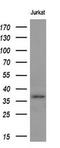 MCL1 Apoptosis Regulator, BCL2 Family Member antibody, GTX84140, GeneTex, Western Blot image 