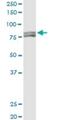 Metastasis Associated 1 antibody, H00009112-M03, Novus Biologicals, Western Blot image 