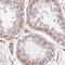 TBK1 Binding Protein 1 antibody, HPA064856, Atlas Antibodies, Immunohistochemistry paraffin image 