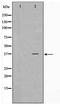 Elongation of very long chain fatty acids protein 4 antibody, TA347692, Origene, Western Blot image 