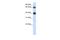 Zinc Finger Containing Ubiquitin Peptidase 1 antibody, A16128, Boster Biological Technology, Western Blot image 