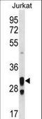 Alkaline Ceramidase 1 antibody, LS-C160997, Lifespan Biosciences, Western Blot image 