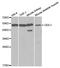 ODC1 antibody, STJ24858, St John