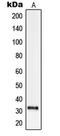 Solute Carrier Family 25 Member 21 antibody, LS-C353609, Lifespan Biosciences, Western Blot image 