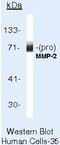 Matrix Metallopeptidase 2 antibody, MA5-13590, Invitrogen Antibodies, Western Blot image 