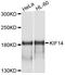 Kinesin Family Member 14 antibody, abx126054, Abbexa, Western Blot image 