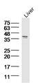 Sirtuin 4 antibody, GTX51798, GeneTex, Western Blot image 