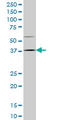 Homeobox D9 antibody, LS-C197452, Lifespan Biosciences, Western Blot image 