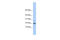 Family With Sequence Similarity 219 Member A antibody, 27-034, ProSci, Western Blot image 