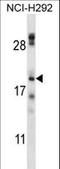 Transmembrane Protein 17 antibody, LS-C161990, Lifespan Biosciences, Western Blot image 