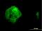 Ubiquilin 2 antibody, H00029978-M03, Novus Biologicals, Immunocytochemistry image 