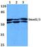 SMAD2 antibody, PA5-36125, Invitrogen Antibodies, Western Blot image 