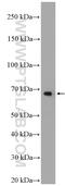 TNF Receptor Associated Factor 5 antibody, 26917-1-AP, Proteintech Group, Western Blot image 