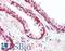 Vav Guanine Nucleotide Exchange Factor 3 antibody, LS-B15490, Lifespan Biosciences, Immunohistochemistry paraffin image 