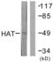 Histone Acetyltransferase 1 antibody, abx013219, Abbexa, Western Blot image 