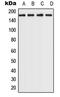 Rho Associated Coiled-Coil Containing Protein Kinase 2 antibody, LS-C353176, Lifespan Biosciences, Western Blot image 