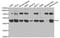 Integrin Linked Kinase antibody, A0901, ABclonal Technology, Western Blot image 