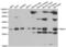 Snail Family Transcriptional Repressor 1 antibody, abx004244, Abbexa, Western Blot image 