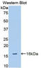 ADAM Metallopeptidase With Thrombospondin Type 1 Motif 1 antibody, LS-C300223, Lifespan Biosciences, Western Blot image 