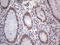 Protein Phosphatase 1 Regulatory Subunit 8 antibody, LS-C339337, Lifespan Biosciences, Immunohistochemistry frozen image 