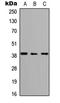 Abhydrolase Domain Containing 4 antibody, LS-C354512, Lifespan Biosciences, Western Blot image 