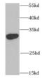 U1 small nuclear ribonucleoprotein A antibody, FNab08068, FineTest, Western Blot image 