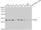 Proteasome Subunit Alpha 6 antibody, A13536, ABclonal Technology, Western Blot image 