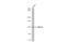 Structural Maintenance Of Chromosomes 6 antibody, GTX116832, GeneTex, Western Blot image 