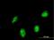 HIC ZBTB Transcriptional Repressor 1 antibody, H00003090-M03, Novus Biologicals, Immunocytochemistry image 