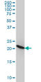 Ribosomal Protein L9 antibody, LS-C133092, Lifespan Biosciences, Western Blot image 